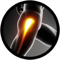 Hip Procedures