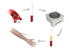 Orthobiologic Treatments for the Elbow
